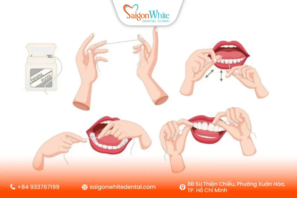 Cách dùng chỉ nha khoa đúng cách