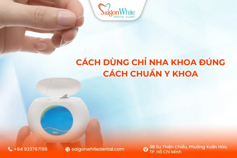 Cách dùng chỉ nha khoa đúng chuẩn y khoa