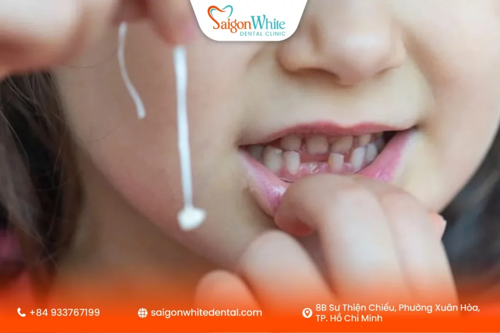 Có nên nhổ răng sữa tại nhà không?