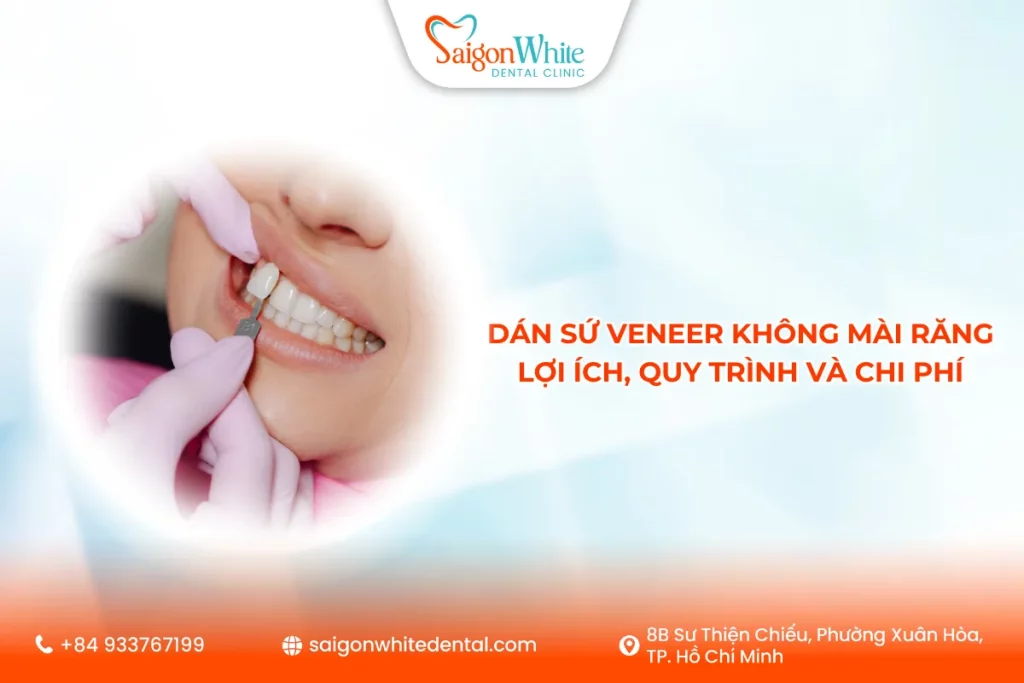 Dán sứ Veneer không mài răng: Lợi ích, quy trình và chi phí