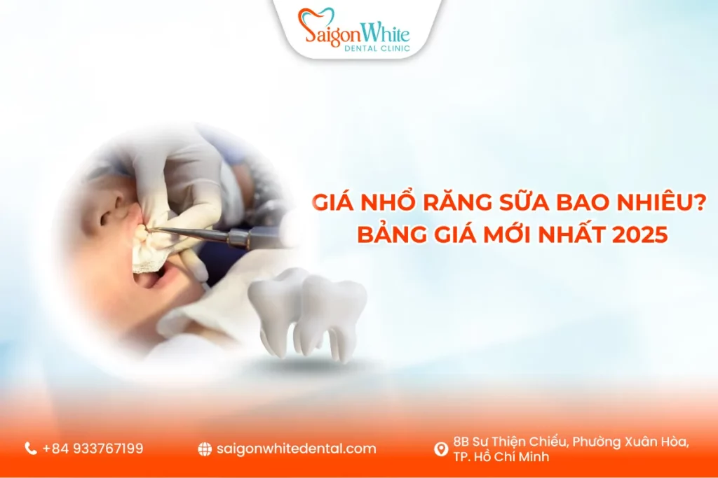 Giá nhổ răng sữa bao nhiêu? Bảng giá mới nhất 2025
