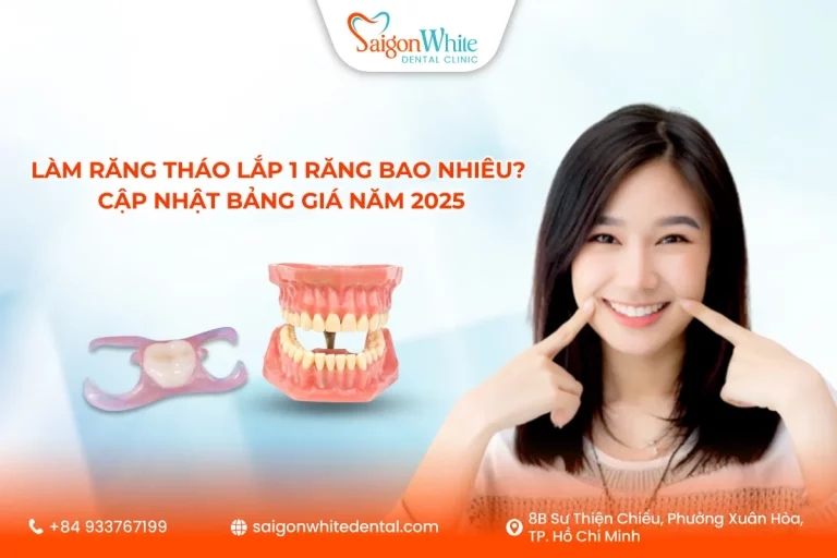 Làm răng tháo lắp 1 răng bao nhiêu? Cập nhật bảng giá năm 2025