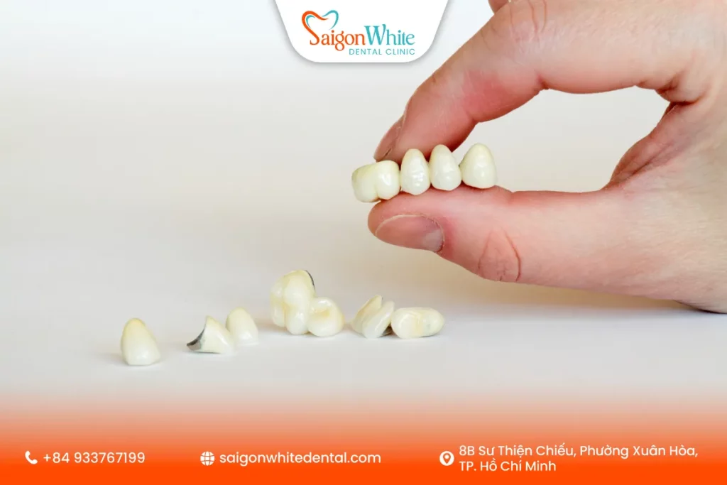 Ưu điểm của làm cầu răng sứ