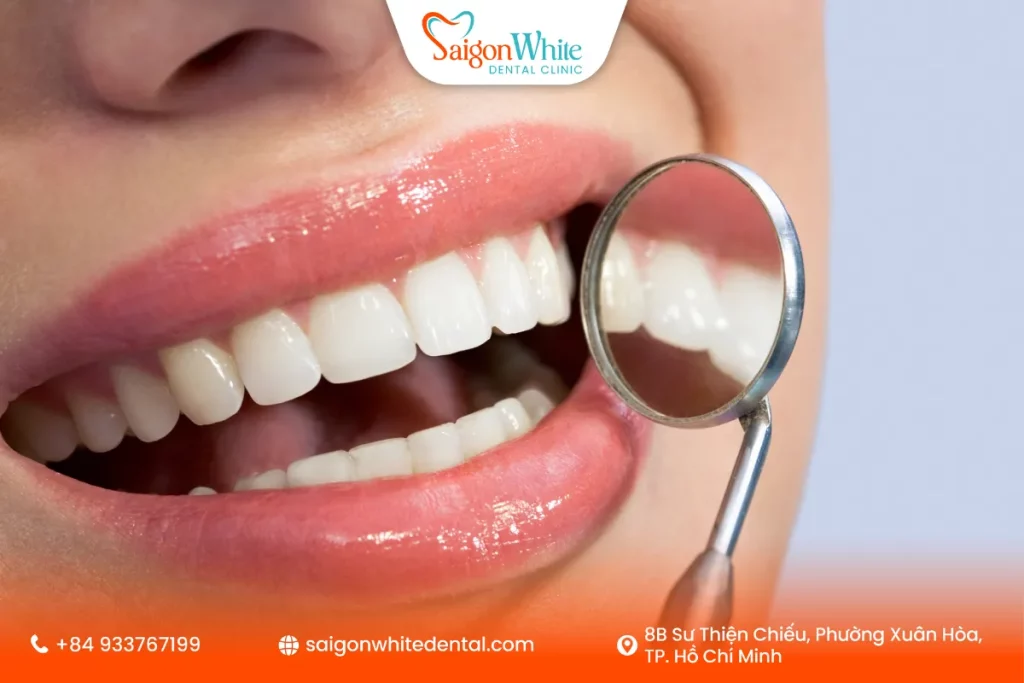 Lợi ích khi chọn nha khoa uy tín làm răng sứ