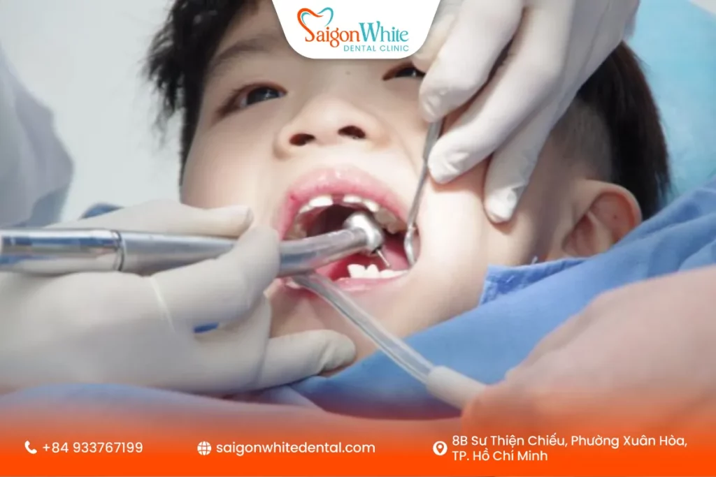 Nên nhổ răng sữa ở đâu an toàn cho trẻ?