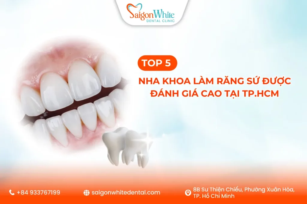 Top 5 nha khoa làm răng sứ được đánh giá cao tại Tp.HCM