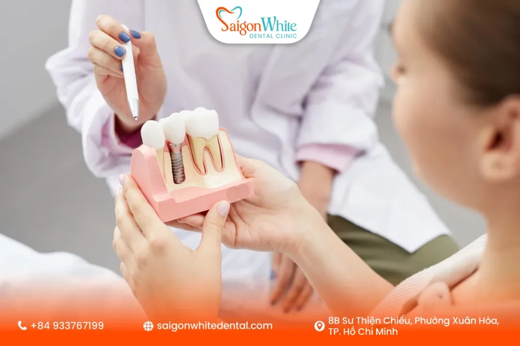 Trồng răng implant giải pháp thay thế nếu không muốn răng tháo lắp