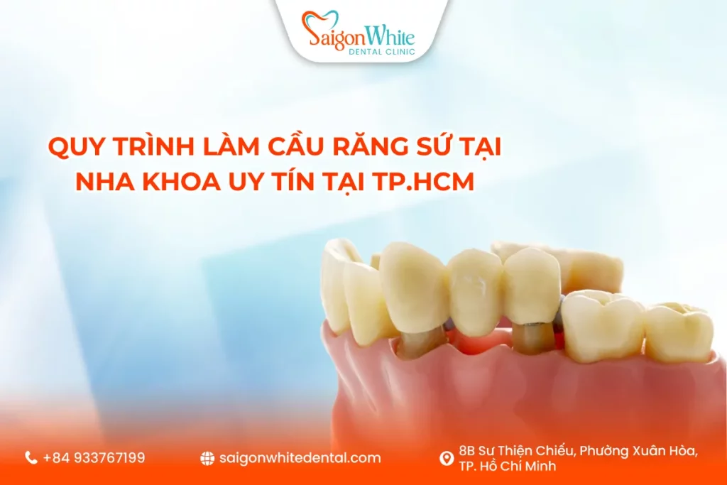 Quy trình làm cầu răng sứ tại nha khoa uy tín tại Tp.HCM