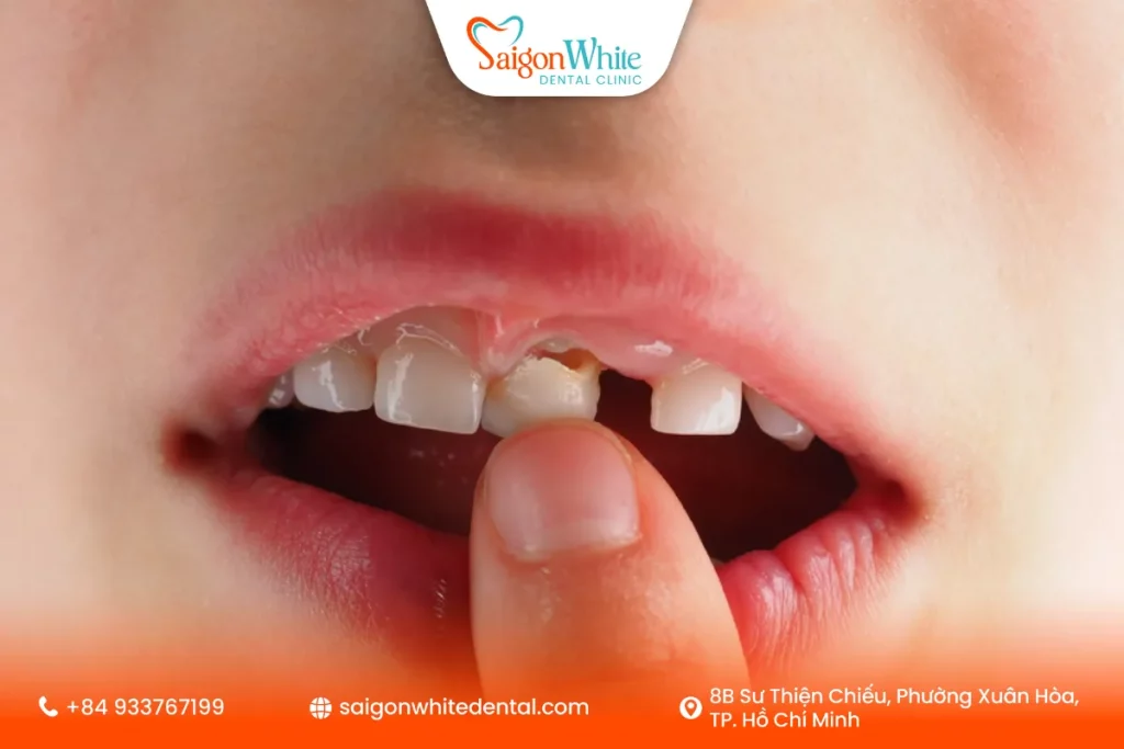 Quy trình thay răng sữa tự nhiên của trẻ