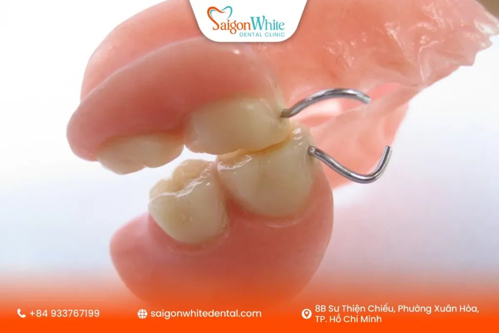 Răng giả tháo lắp 2 răng nền mềm phù hợp với người lớn tuổi mất răng lâu năm