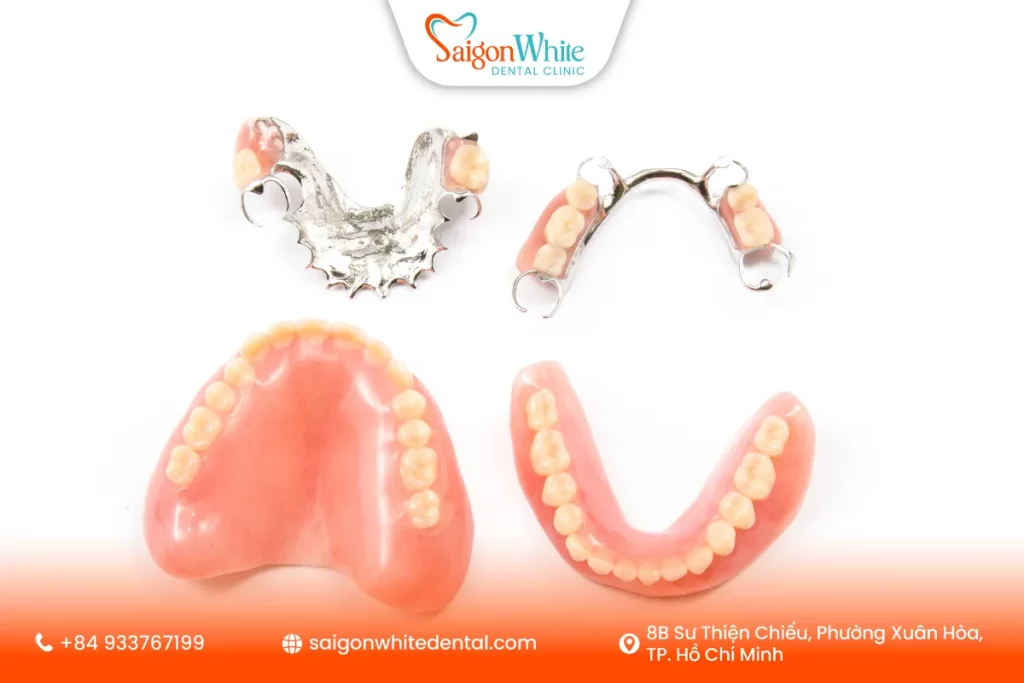 Răng giả tháo lắp - giải pháp phục hình răng 