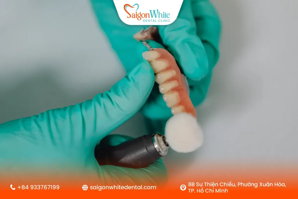 Răng giả tháo lắp sử dụng được bao lâu?