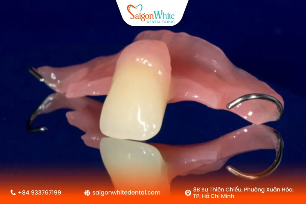 Ưu điểm của làm răng tháo lắp 1 răng