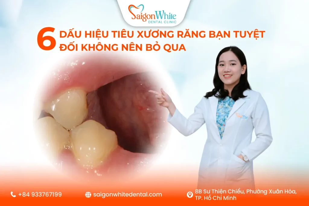 6 Dấu Hiệu Tiêu Xương Răng Bạn Tuyệt Đối Không Nên Bỏ Qua