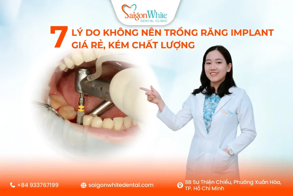 7 Lý Do Không Nên Trồng Răng Implant Giá Rẻ, Kém Chất Lượng