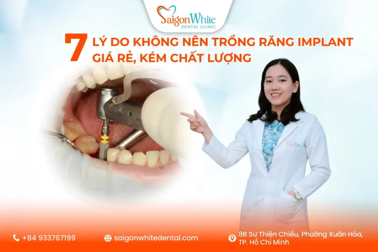 7 Lý Do Không Nên Trồng Răng Implant Giá Rẻ, Kém Chất Lượng