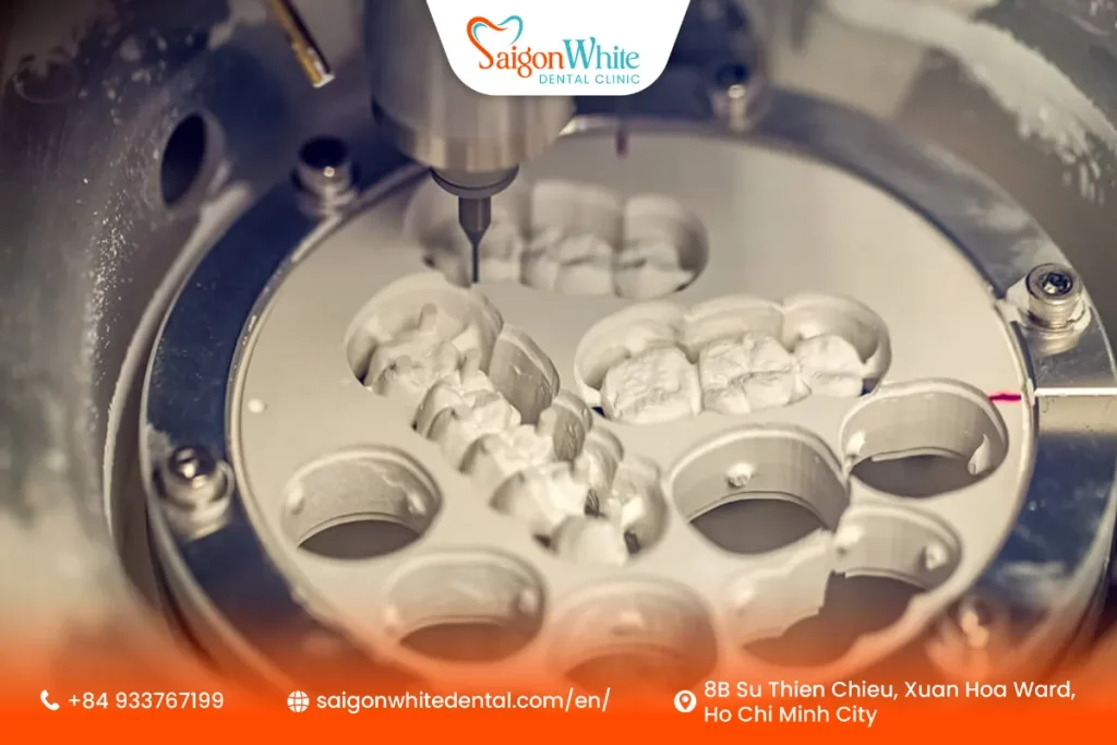 CAD/CAM Technology and Digital Smile Design