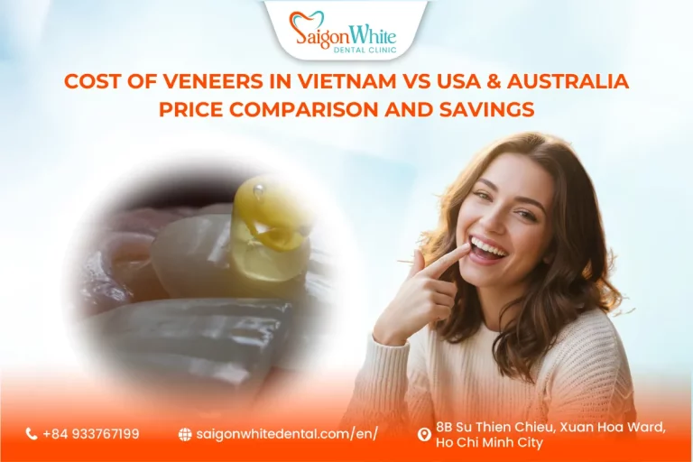 Cost of Veneers in Vietnam vs USA & Australia Price Comparison and Savings