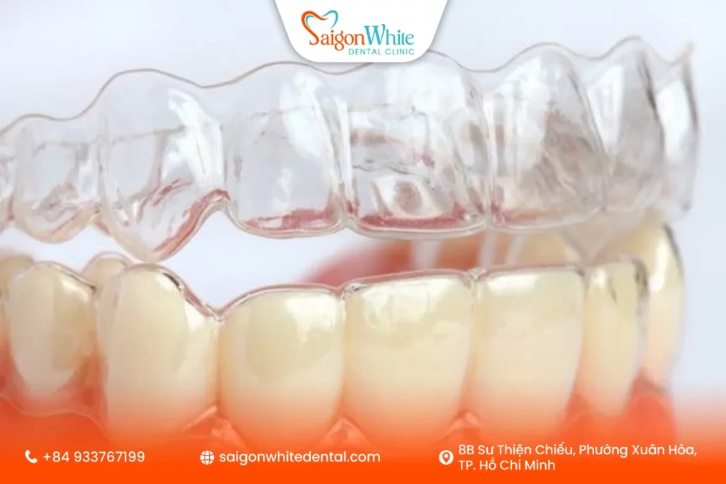 Hàm duy trì tháo lắp trong suốt