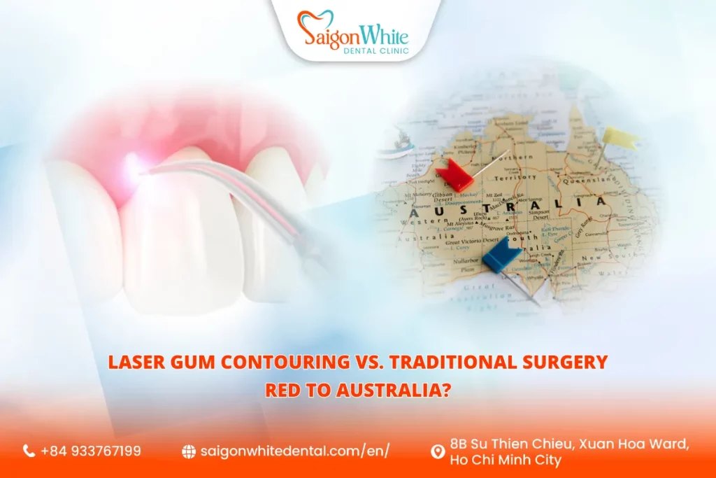 Laser Gum Contouring vs. Traditional Surgery: Which One Is Better?