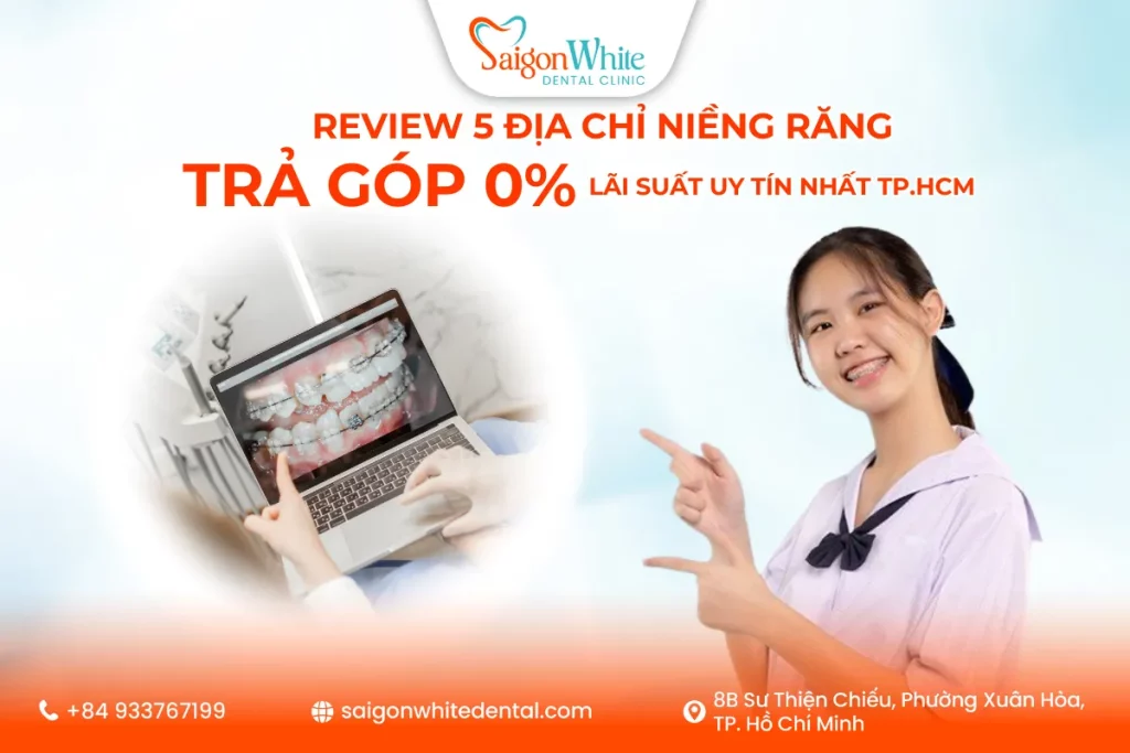 Review 5 địa chỉ niềng răng trả góp 0% lãi suất uy tín nhất TP.HCM năm 2025