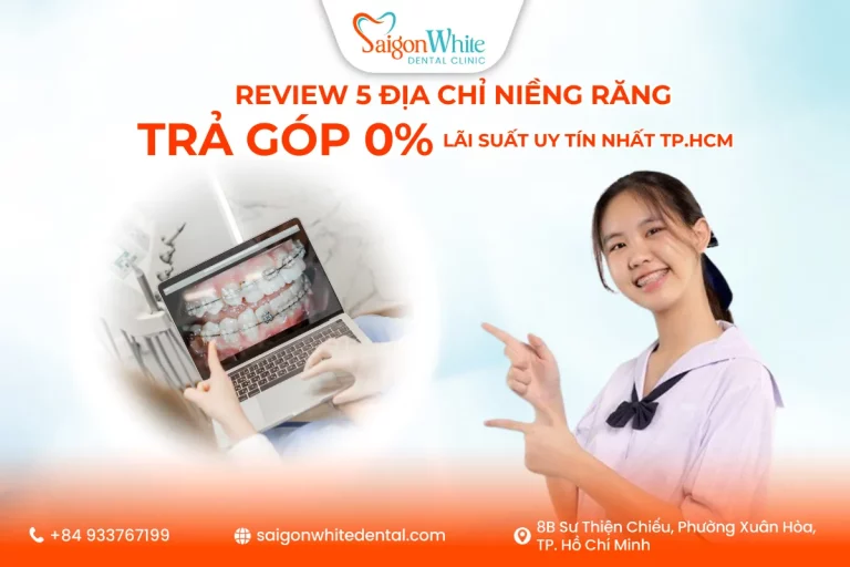 Review 5 địa chỉ niềng răng trả góp 0% lãi suất uy tín nhất TP.HCM năm 2025