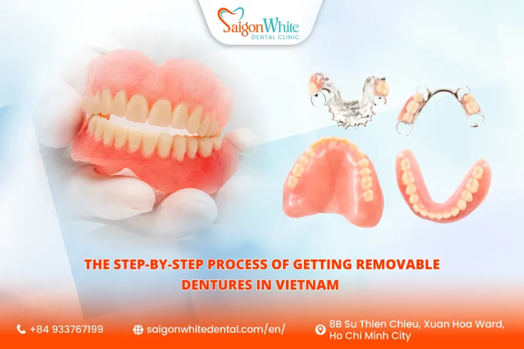 The Step-by-Step Process of Getting Removable Dentures in Vietnam