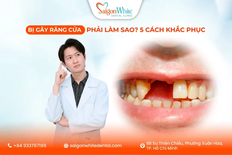 Bị gãy răng cửa phải làm sao? 5 cách khắc phục