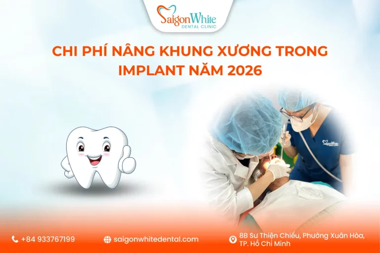 Chi phí nâng khung xương trong implant năm 2026