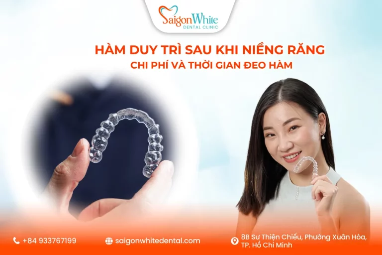 Hàm Duy Trì Sau Khi Niềng Răng: Chi Phí Và Thời Gian Đeo Hàm