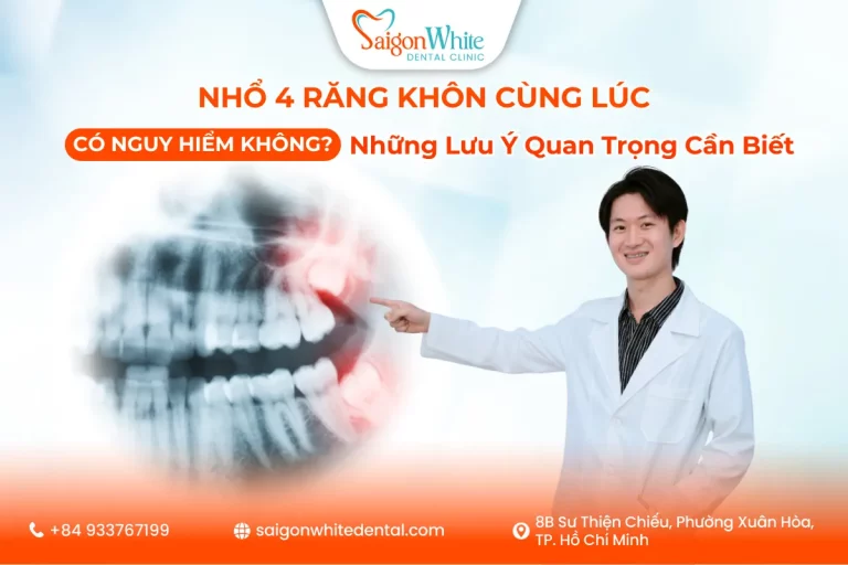 Nhổ 4 Răng Khôn Cùng Lúc Có Nguy Hiểm Không? Những Lưu Ý Quan Trọng Cần Biết