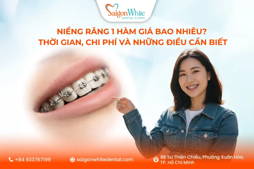 Niềng răng 1 hàm giá bao nhiêu? Thời gian, chi phí và những điều cần biết