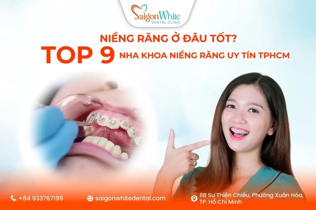 Niềng răng ở đâu tốt? Top 9 nha khoa niềng răng uy tín TPHCM