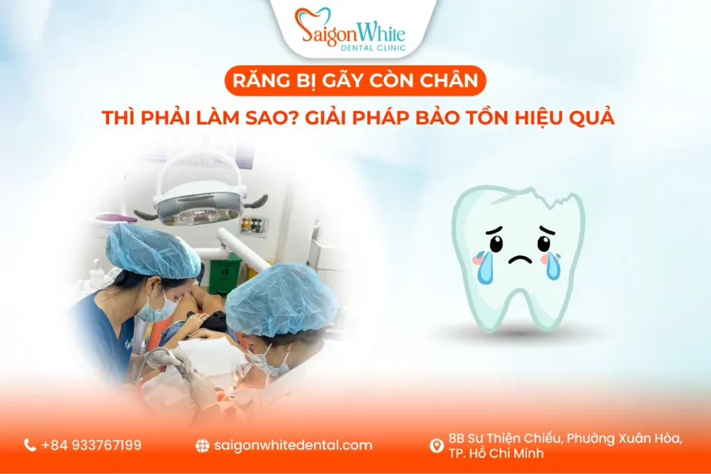 Răng bị gãy còn chân thì phải làm sao? Giải pháp bảo tồn hiệu quả