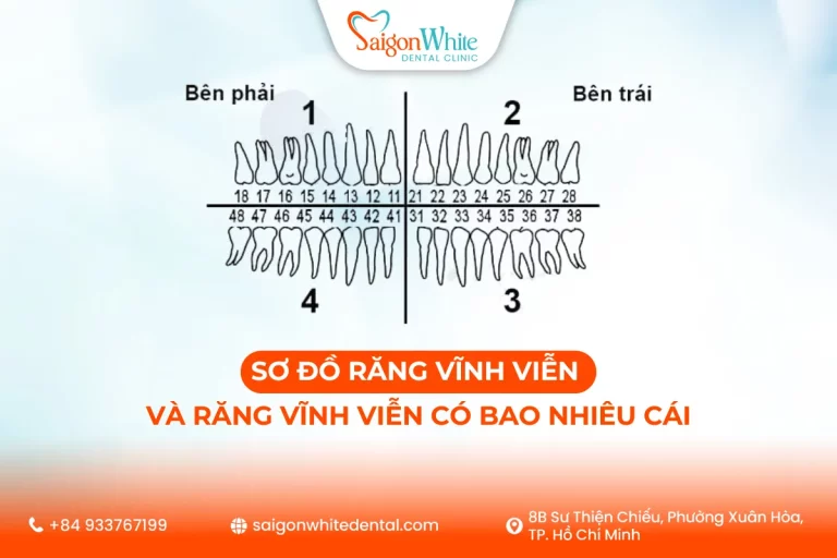 Sơ Đồ Răng Vĩnh Viễn Và Răng Vĩnh Viễn Có Bao Nhiêu Cái