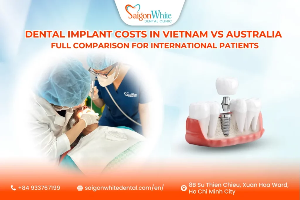 Dental Implant Costs in Vietnam vs Australia: Full Comparison for International Patients
