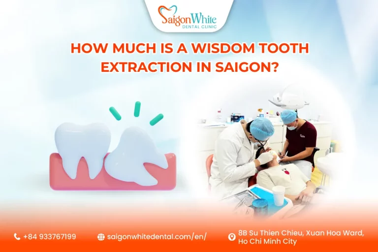 How Much is a Wisdom Tooth Extraction in Saigon?