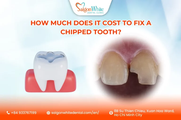How much does it cost to fix a chipped tooth?