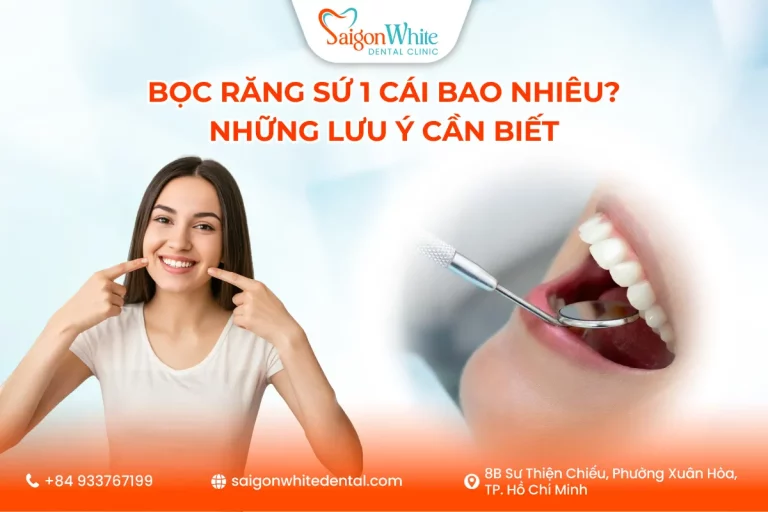Bọc Răng Sứ 1 Cái Bao Nhiêu? Những Lưu Ý Cần Biết