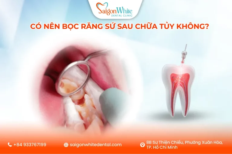 Có Nên Bọc Răng Sứ Sau Chữa Tủy Không?