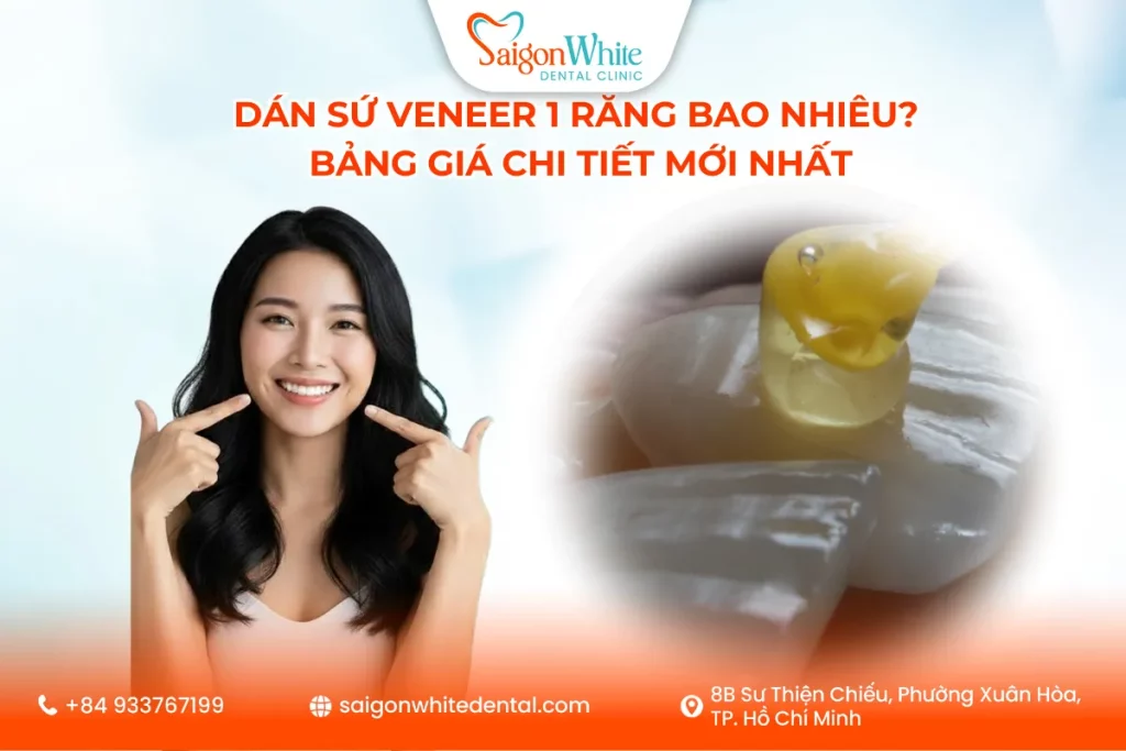 Dán Sứ Veneer 1 Răng Bao Nhiêu? Bảng Giá Chi Tiết Mới Nhất