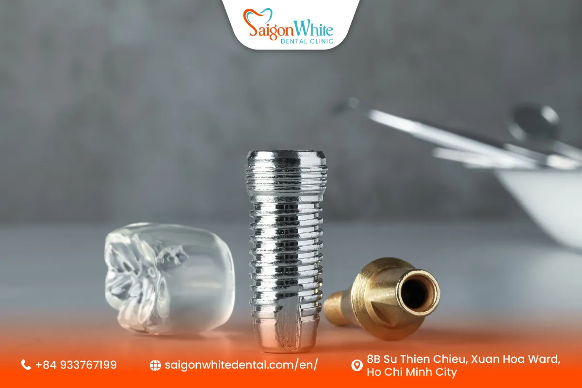 Single Tooth Implant