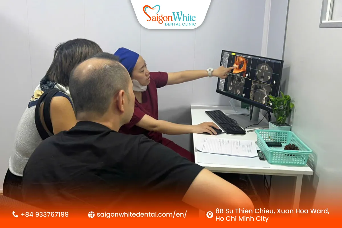 Who Should Get Dental Implants