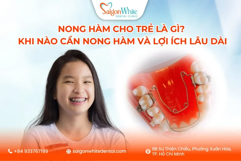 Nong hàm cho trẻ là gì? Khi nào cần nong hàm và lợi ích lâu dài