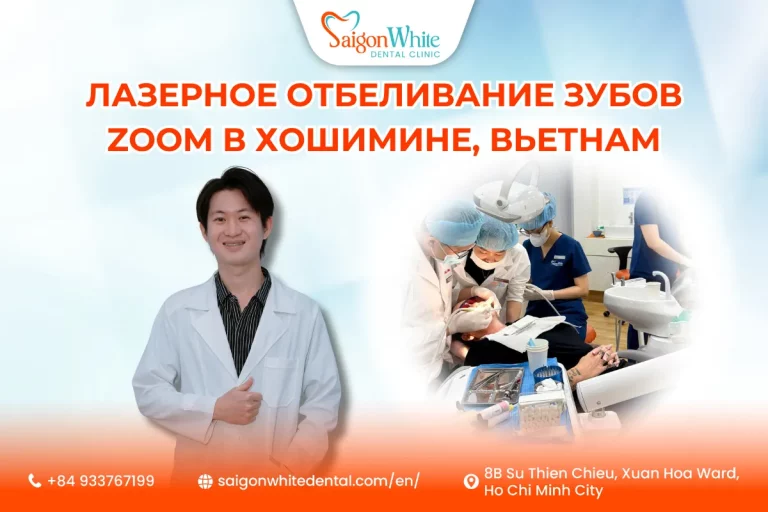 Лазерное отбеливание зубов Zoom в Хошимине, Вьетнам