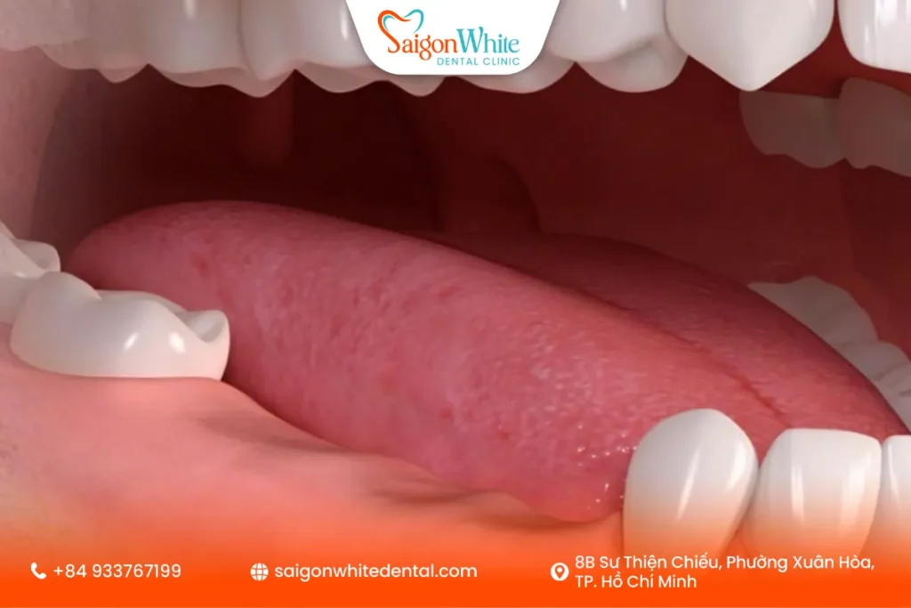 Vì sao mất răng lâu ngày làm xương hàm yếu đi?