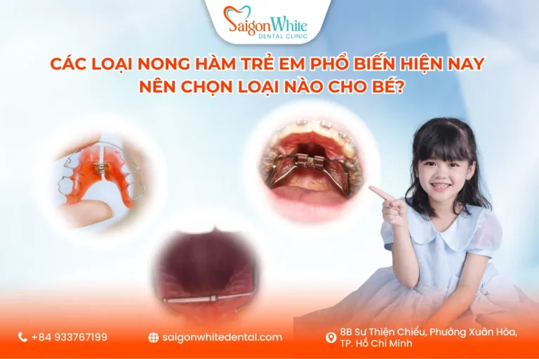 Các Loại Nong Hàm Trẻ Em Phổ Biến Hiện Nay – Nên Chọn Loại Nào Cho Bé?
