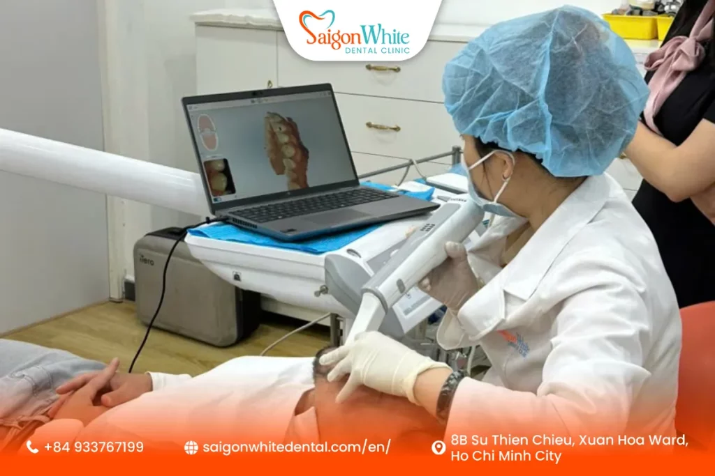 iTero Element 5D dental scan (preview results)