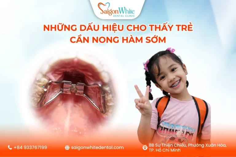 Những Dấu Hiệu Cho Thấy Trẻ Cần Nong Hàm Sớm