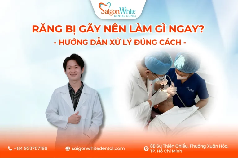 Răng Bị Gãy Nên Làm Gì Ngay? Hướng Dẫn Xử Lý Đúng Cách